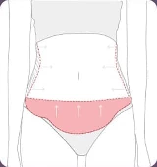 복부 채취 범위와 방향을 표시한 그림