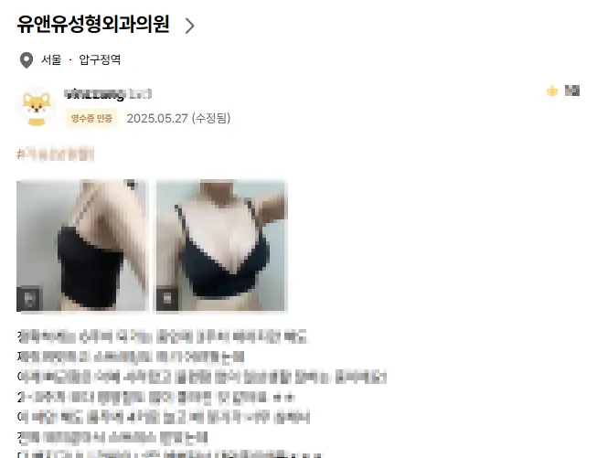 가슴재수술시기? 사이즈불만족 / 부작용 등 상황에 따라 알려드립니다. <20년의 연구 경험으로 드리는 조언 > — 본문 이미지 2