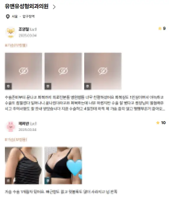 가슴축소술, 사이즈별 절개 방법까지 20년의 연구 경험으로 알려드립니다. — 본문 이미지 9