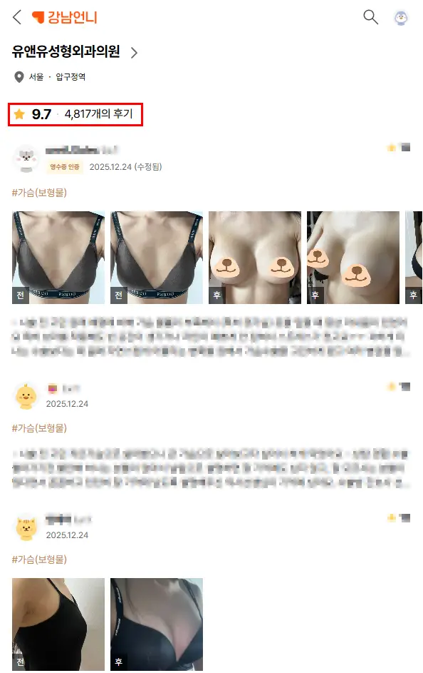 처진가슴수술비용, 거상술 / 보형물이 필요한 경우도 정리해드리겠습니다. <20년의 연구경험으로 드리는 조언> — 본문 이미지 3