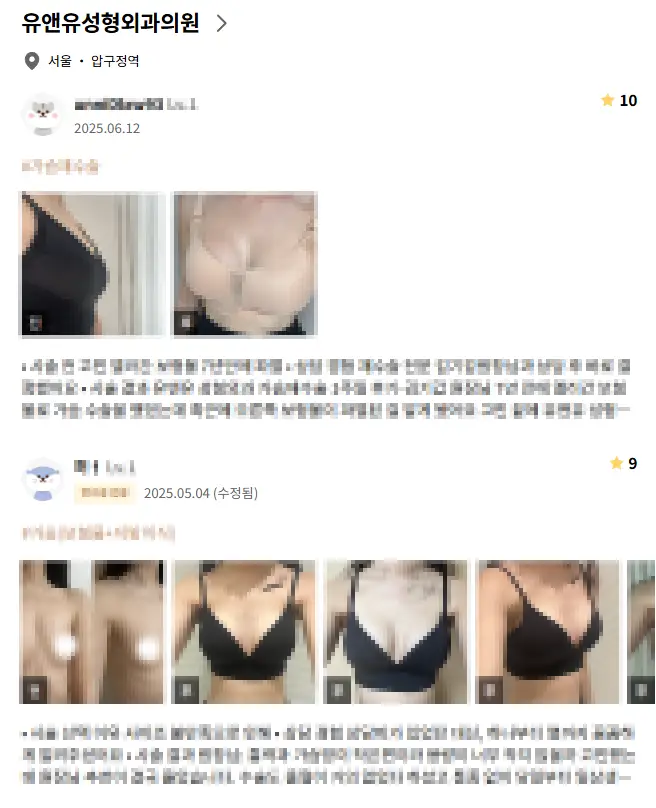 20여년 전부터 가슴성형만을 연구해온 기록