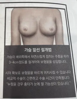 가슴수술종류, 겨드랑이/밑선 절개? 장단점에 대하여 (20년 연구 경험) — 본문 이미지 8