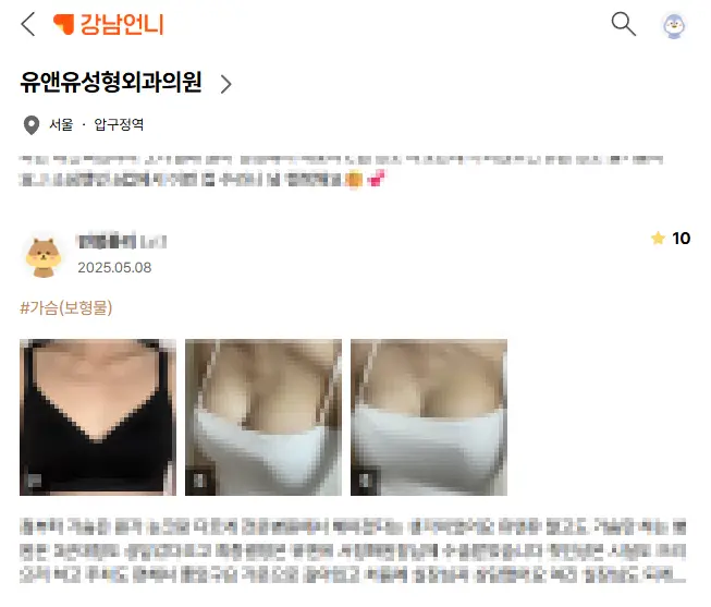 가슴수술병원? 작년에만 3000건 이상 수술한 곳에서 알려주는 주의사항 — 본문 이미지 6