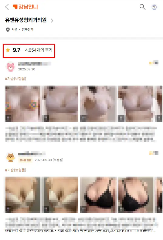 벨라젤보형물 파열, 수술할 때 피막을 꼭 제거해야할까? <작년 모티바 사용량 최다 병원 작성> — 본문 이미지 3
