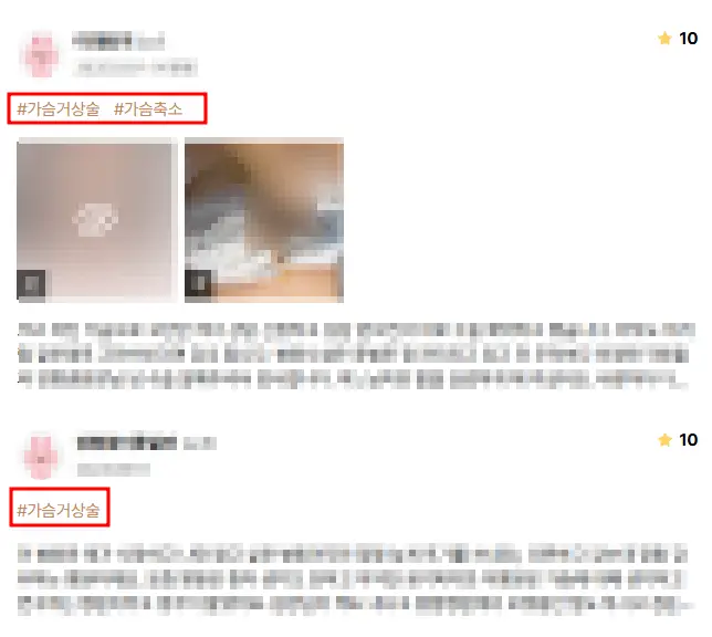 처진가슴수술비용, 거상술 / 보형물이 필요한 경우도 정리해드리겠습니다. <20년의 연구경험으로 드리는 조언> — 본문 이미지 7