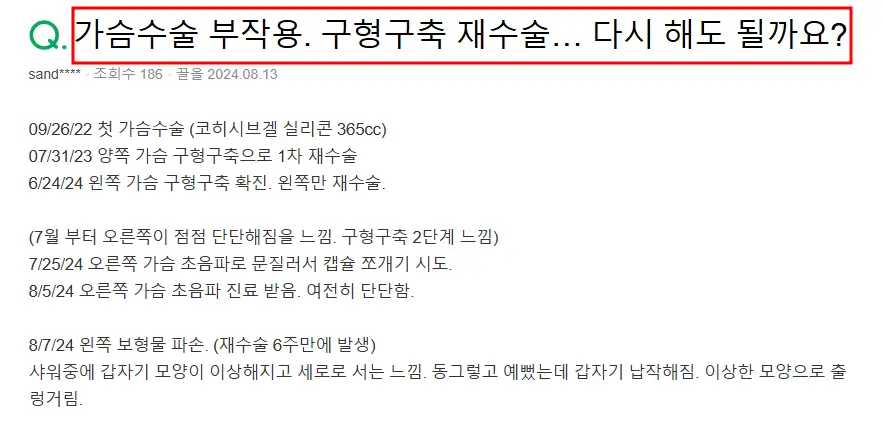가슴수술비용? 보형물 제조사의 신뢰를 이어온 곳에서 알려드리겠습니다. — 본문 이미지 10