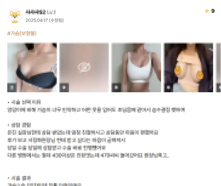 모티바 가격? 작년 모티바 사용량 1위 병원에서 알려드리겠습니다. — 본문 이미지 3