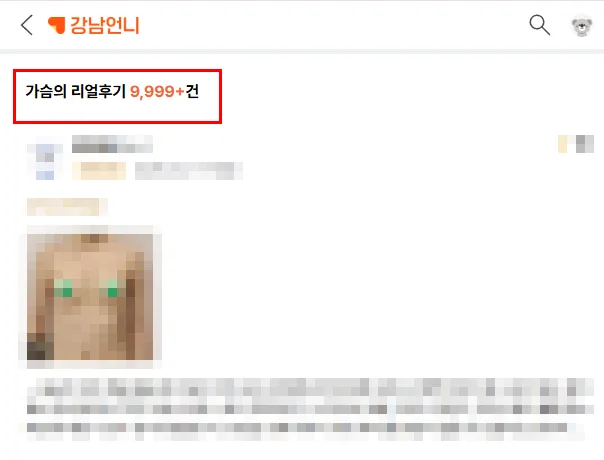 모티바후기, 전후 사진은 많은데 사후관리 언급은 없는 이유<20년 가슴성형만 연구한 곳 작성> — 본문 이미지 4