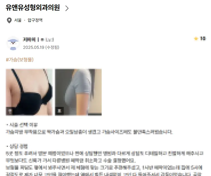 가슴수술피주머니, 꼭 해야 되는 건가? — 본문 이미지 1