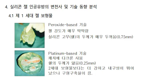 가슴수술10년, 보형물 교체? 20년의 경험을 바탕으로 조언 드립니다. — 본문 이미지 7