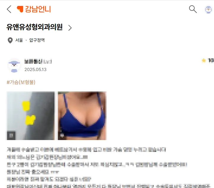 강남가슴수술? '이런 곳'을 추천드립니다. <20년의 연구경험을 바탕으로 드리는 조언> — 본문 이미지 2