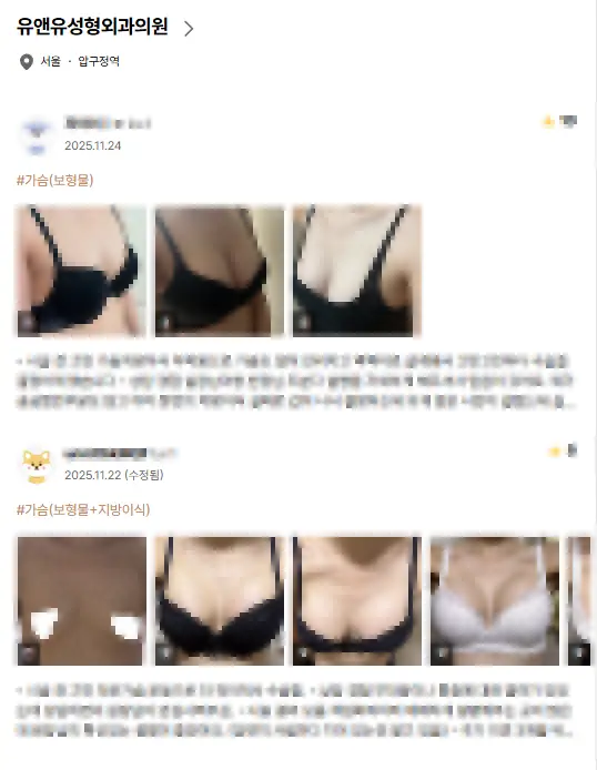 가슴성형외과? 후기에 속지 않으려면 알아야 할 2가지. <20년의 연구경험으로 드리는 조언> — 본문 이미지 2