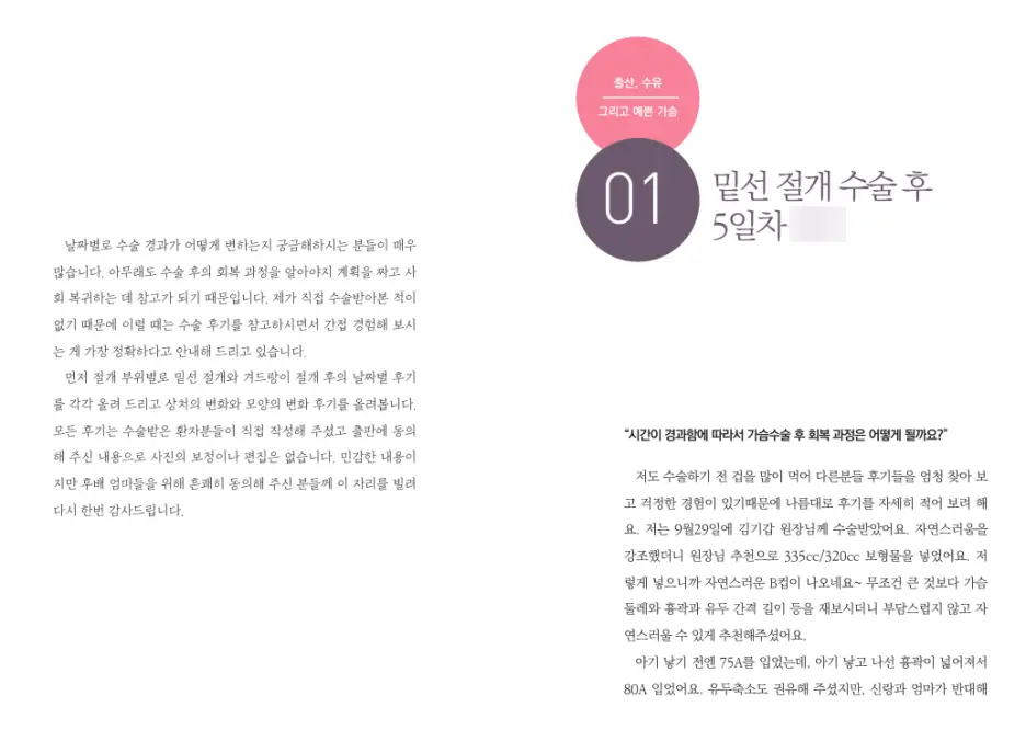 유방확대술비용? 1가지가 수십 수백만원을 결정합니다. <20년의 연구 경험으로 드리는 조언> — 본문 이미지 4