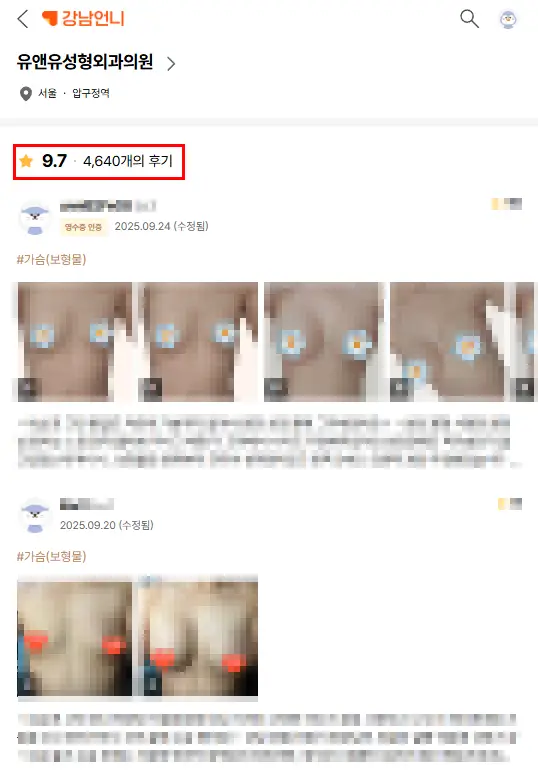가슴보형물터짐, 무조건 MRI를 찍어야 할까? 초음파로 검사할 수 있지 않을까 — 본문 이미지 2