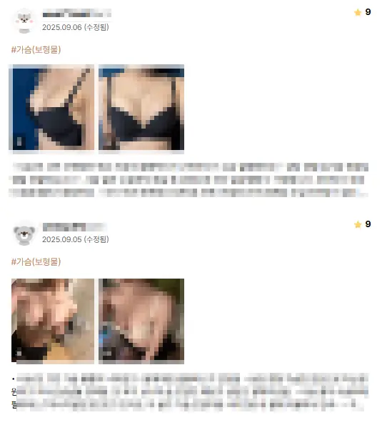 가슴확대수술비용, 평균만 따져도 몇백만원씩 차이나는 이유? — 본문 이미지 5