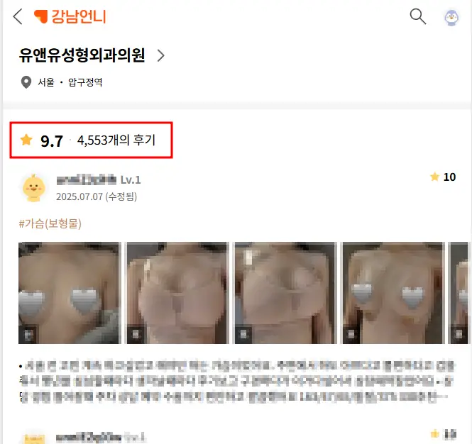 성예사, 가슴성형 후기에서 손품팔다가 간과하기 쉬운 3가지 — 본문 이미지 1