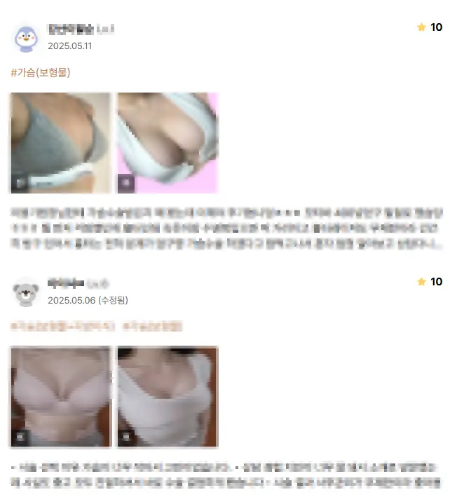가슴수술병원? 작년에만 3000건 이상 수술한 곳에서 알려주는 주의사항 — 본문 이미지 2