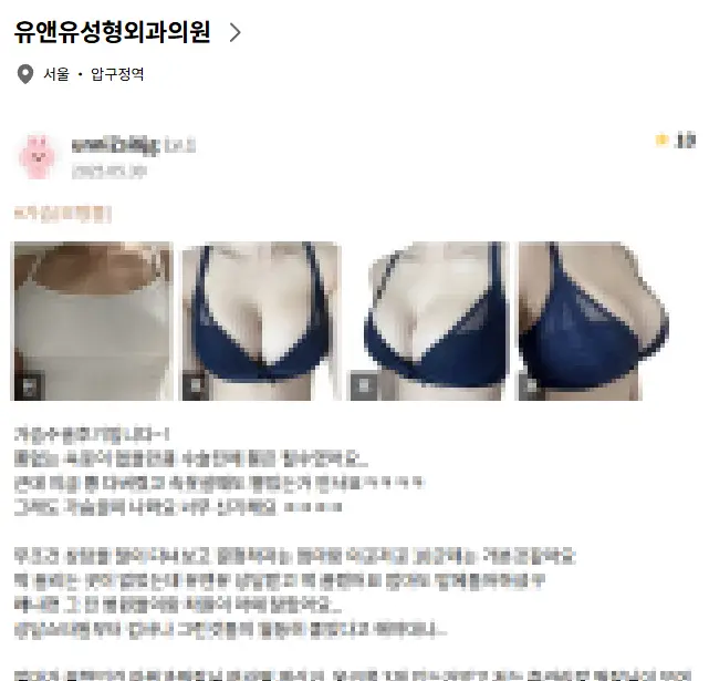 20여년 전부터 가슴성형만을 연구해온 기록들