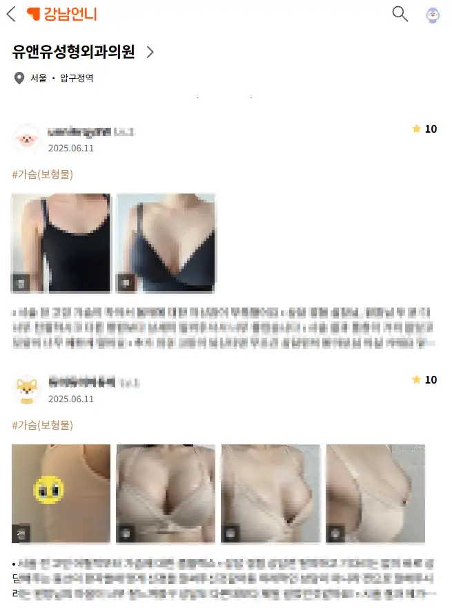 모티바가슴성형비용, 지방이식도 안 하는데 왜 병원마다 천차만별일까? — 본문 이미지 19