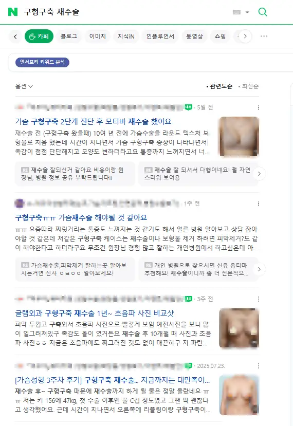 부산가슴수술? 성형 후 26년 뒤 나타난 부작용 사례로 보는 주의사항. — 본문 이미지 11
