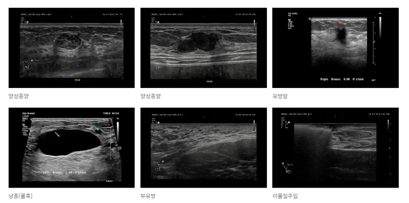 가슴성형병원, 규모가 크면 안심할 수 있을까? 결정 전 확인할 3가지 정리해드립니다. — 본문 이미지 12