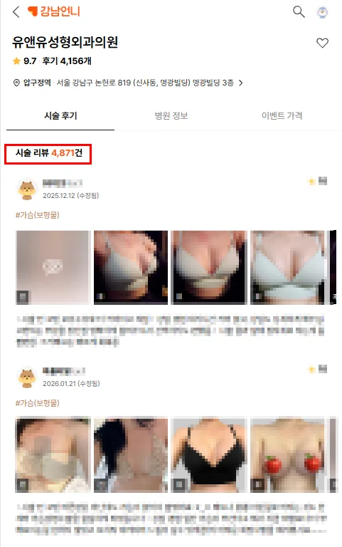 가슴수술통증? 확대/축소/거상술별로 총정리합니다. <20년의 연구경험으로 드리는 조언> — 본문 이미지 3