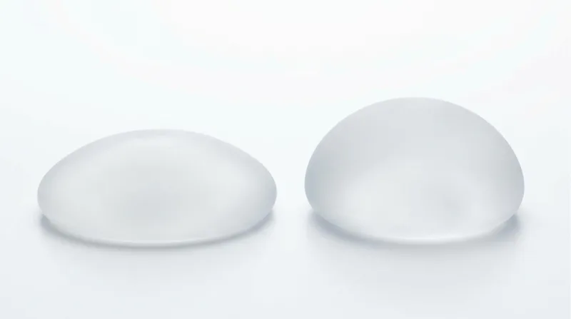짝가슴교정, 보형물 종류 다르게 넣으면 해결될까? <작년 3,404건 보형물 이식한 병원 작성> — 본문 이미지 5
