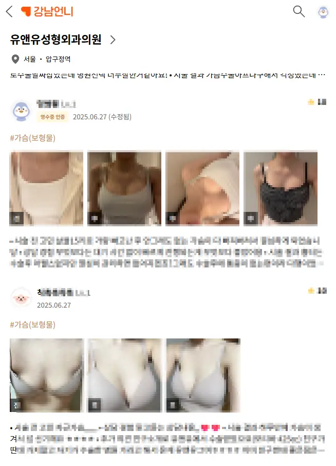 처진가슴수술후기? 속지 마세요. — 본문 이미지 14