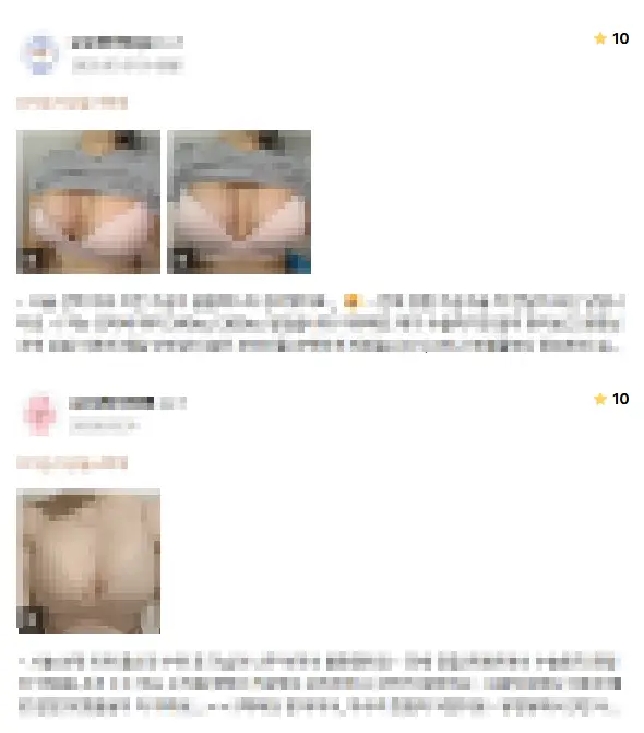 가슴수술사이즈? 병원에서는 이런 기준으로 권합니다. <20년 연구경험> — 본문 이미지 8