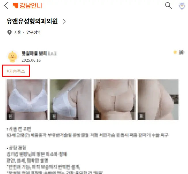 20여년 전부터 가슴성형만을 연구해온 기록들
