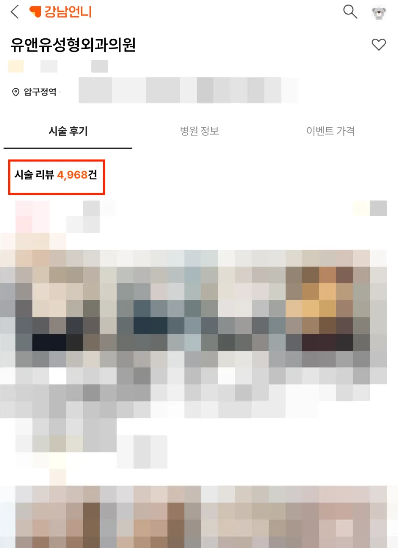 모티바가슴수술, 왜 유독 많이 할까? <4,784명의 연구결과로 본 진짜 이유> — 본문 이미지 2