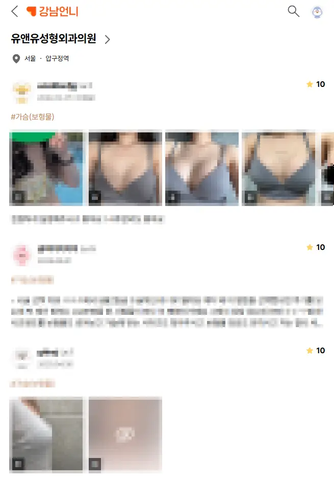 가슴옆빠짐? 수술 후 이런 경우라면 재수술이 필요할 수 있습니다. — 본문 이미지 9