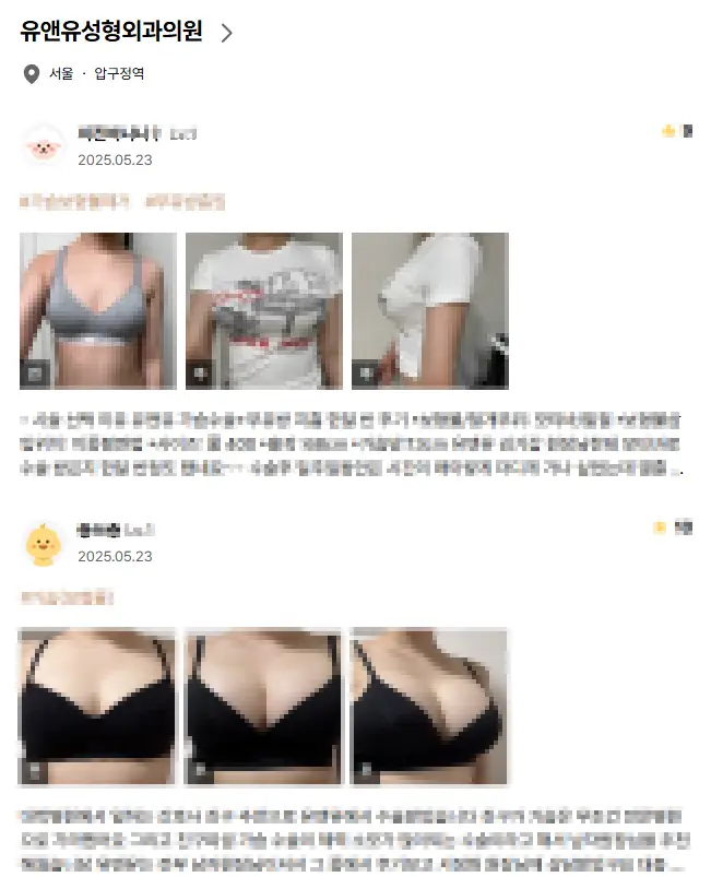 20여년 전부터 가슴성형만을 연구해온 기록들