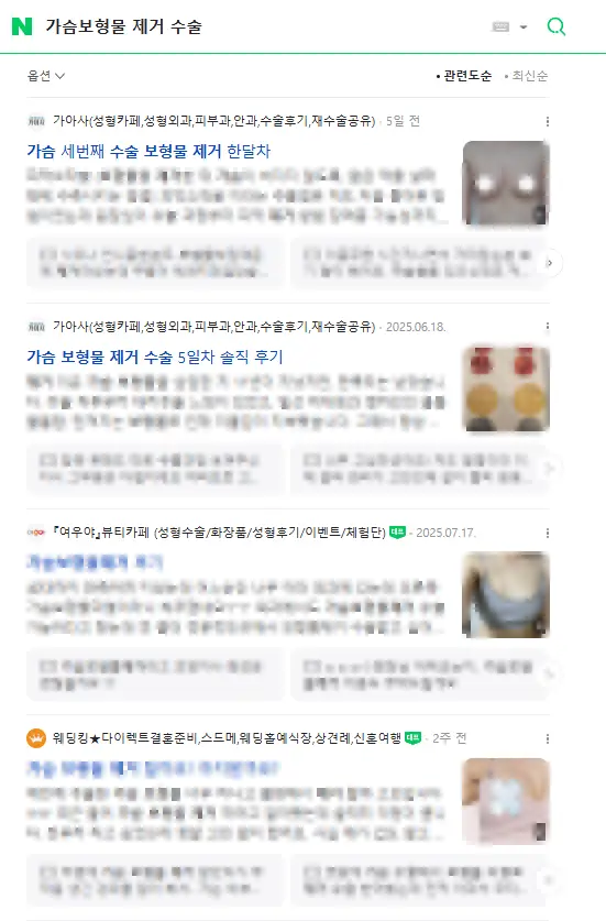 가아사 카페? 가슴성형 후기에서 확인할 수 없는 2가지 — 본문 이미지 9
