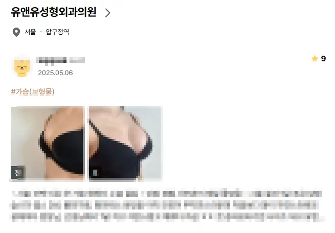 가슴성형병원, 내원 전 2가지 주의사항 <20년의 연구 경험으로 드리는 조언> — 본문 이미지 2
