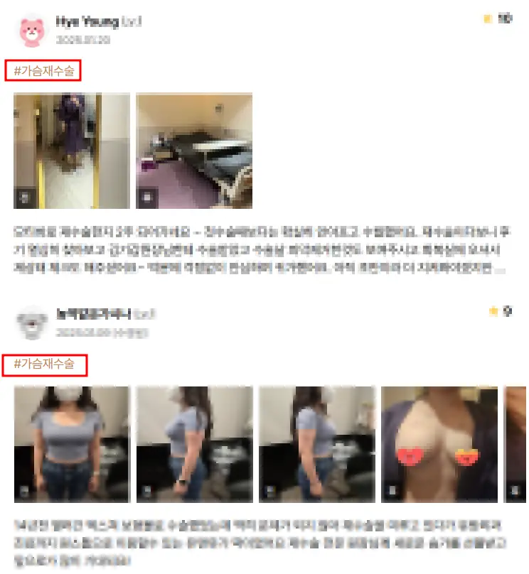 가슴재수술비용, 왜 첫 수술에 비해 더 비싸다고 할까 <20년의 연구 경험으로 드리는 조언> — 본문 이미지 4
