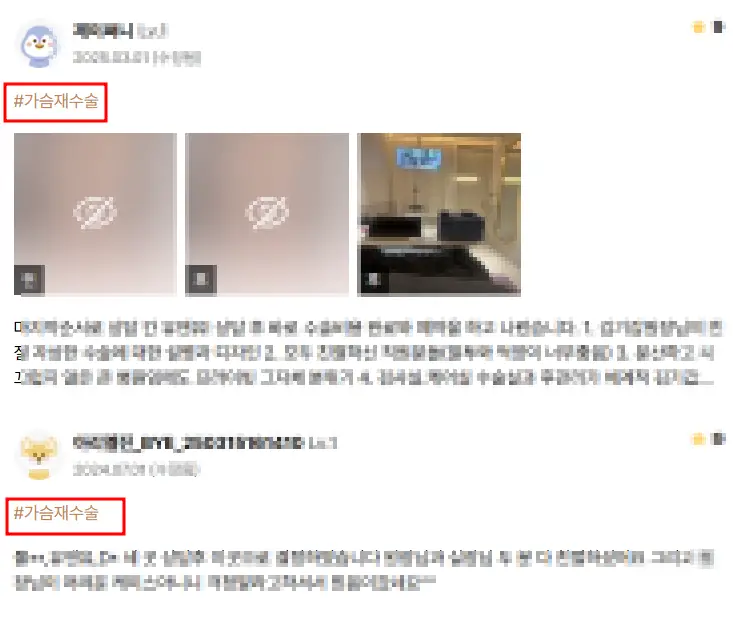 가슴수술구형구축, 실제 논문으로 보는 재수술 후기 — 본문 이미지 8