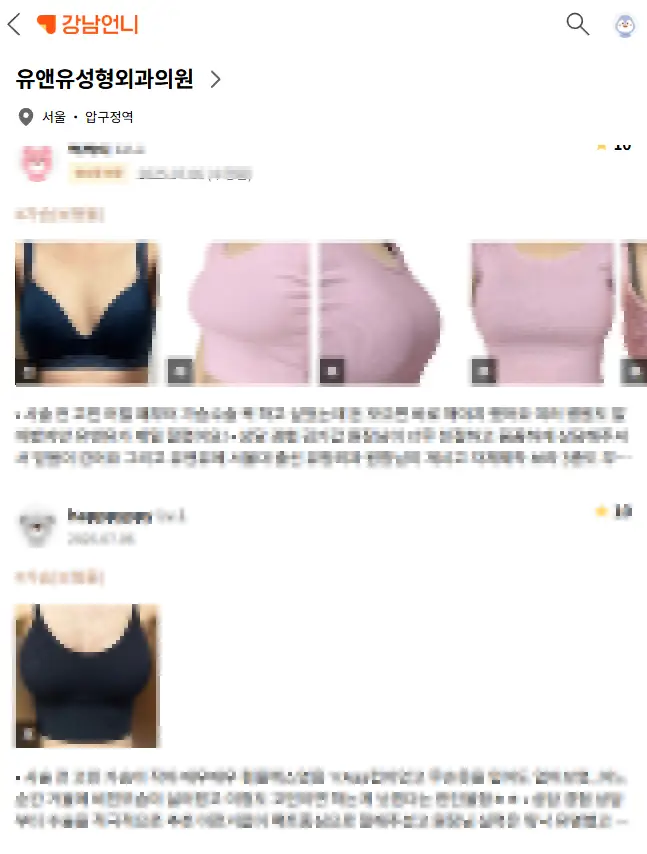 가슴보형물제거후기? 2편의 논문으로 알아보는 모양/신체 변화 — 본문 이미지 7