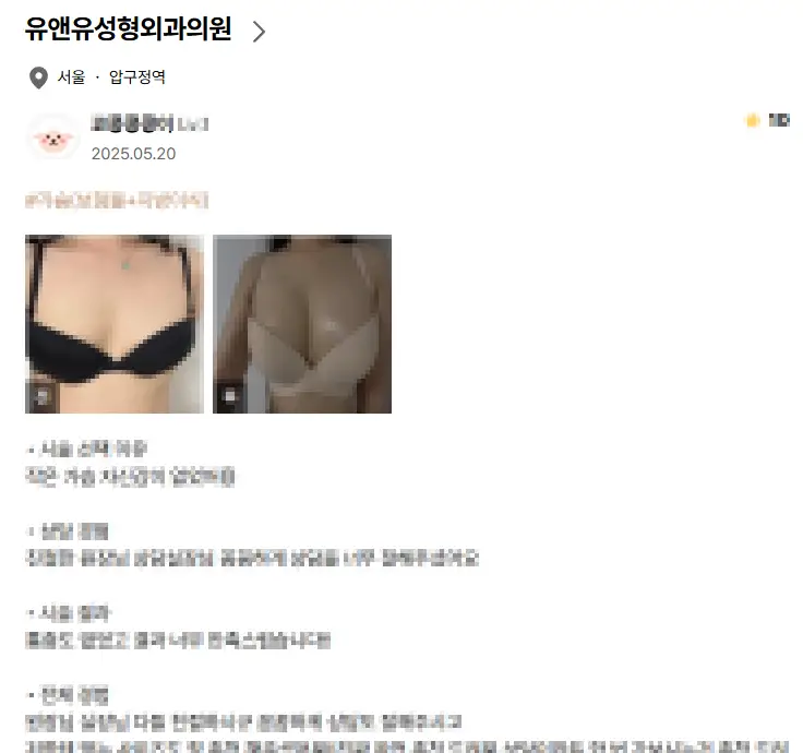 가슴수술피주머니, 꼭 해야 되는 건가? — 본문 이미지 2