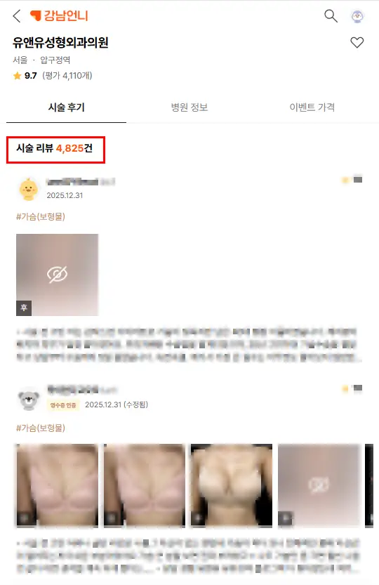 가슴수술모유수유, 문제없을까? 완모할 때쯤이면 보형물 무게로 더 처져있지 않을까 — 본문 이미지 2