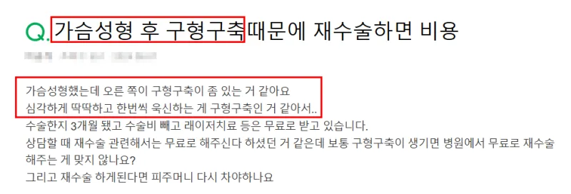 압구정가슴수술, 구형구축·보형물 파열 피하려면 2가지 기준 확인하세요. (20년 가슴성형 전문의 작성) — 본문 이미지 8