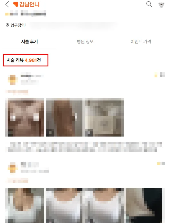 모티바프리저베 과연 안전할까?<수술 후 3년 연구 결과로 보는 주의사항 > — 본문 이미지 2