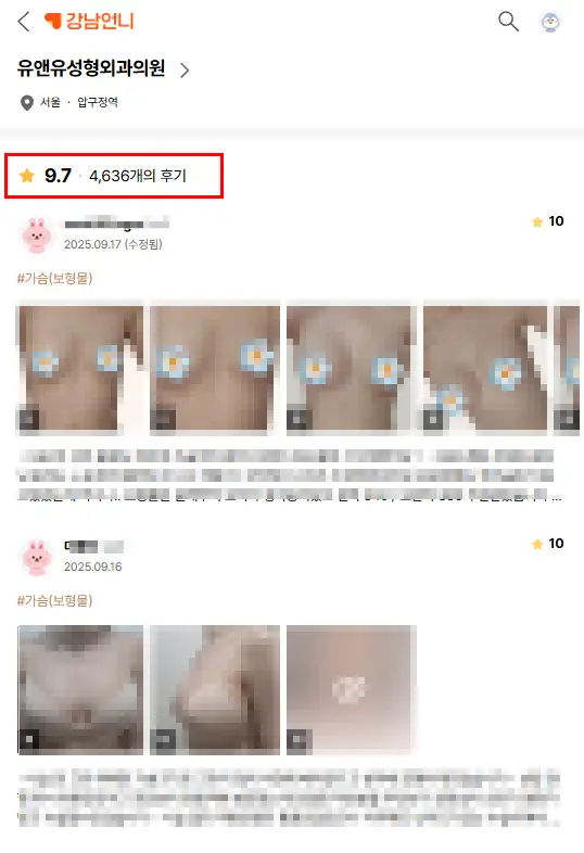 가슴성형부작용후기, 구형구축 n일차? 유독 찾기 어려운 이유 <20년의 연구경험으로 드리는 조언> — 본문 이미지 1