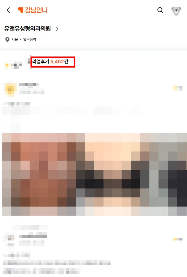 구형구축약, 꼭 먹어야 할까? 20년간 가슴성형만 연구한 곳에서 드리는 조언 — 본문 이미지 1