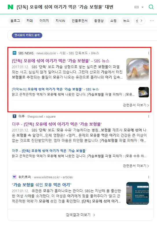 가슴성형모유수유 부작용 없을까? <20년의 경험으로 드리는 조언> — 본문 이미지 2