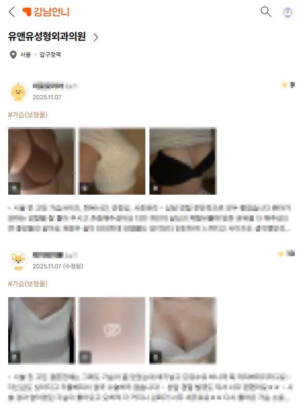 짝가슴교정? 보형물 성형으로 비대칭 맞출 수 있을까? <402명의 연구 사례로 보는 주의사항> — 본문 이미지 6