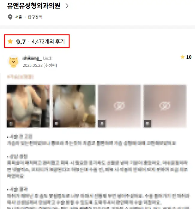 강남언니 어플, 가슴성형 후기/이벤트? 너무 눈여겨 보진 마세요. — 본문 이미지 1