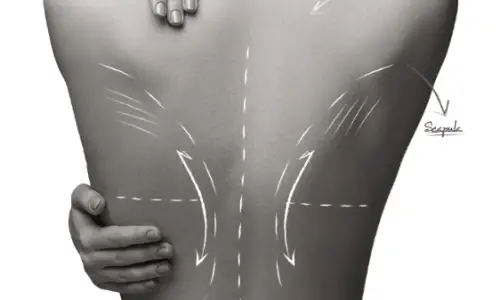 가슴수술회복기간, 왜 누구는 3일 뒤에 바로 출근할 수 있는 걸까? <20년의 연구 경험으로 드리는 답변> — 본문 이미지 21