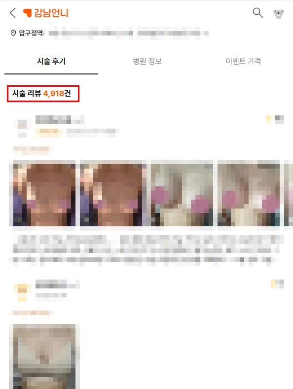 처진가슴수술비용, 가슴크림·보정속옷 후기에 속지 마세요 <20년간 가슴만 연구한 의료진 작성> — 본문 이미지 2
