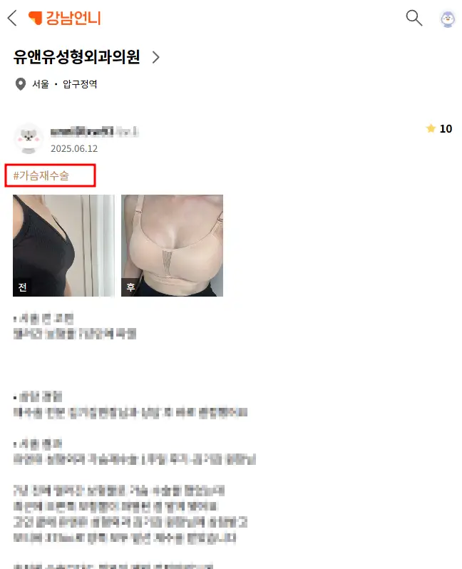 가슴재수술후기, 사이즈 불만족/ 보형물 교체? 논문으로 알아보는 수술 안정성 — 본문 이미지 1